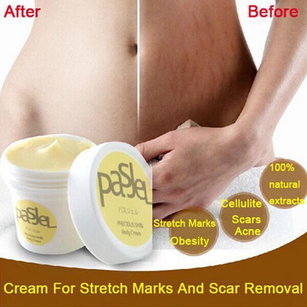 Scar Removal Cream