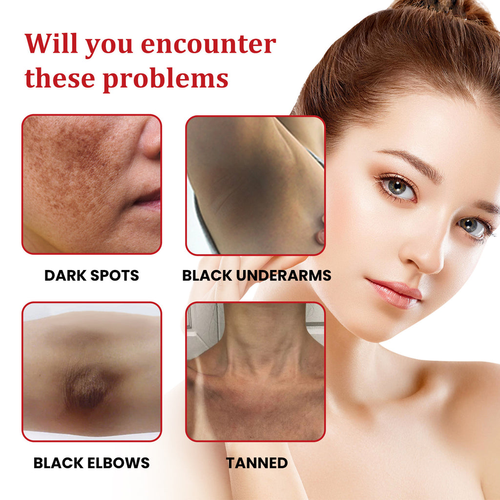 Black Spot Repair Cream