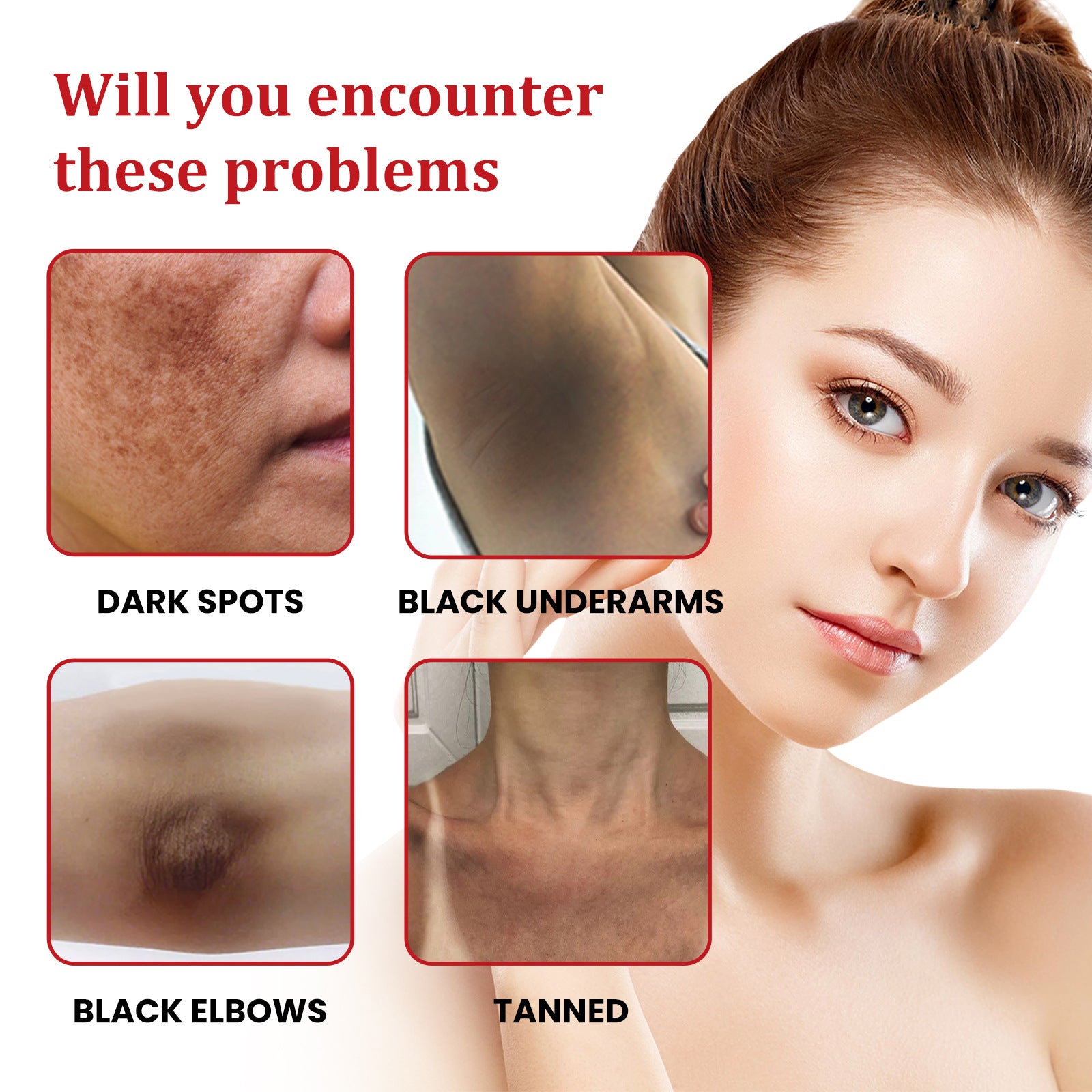 Black Spot Repair Cream