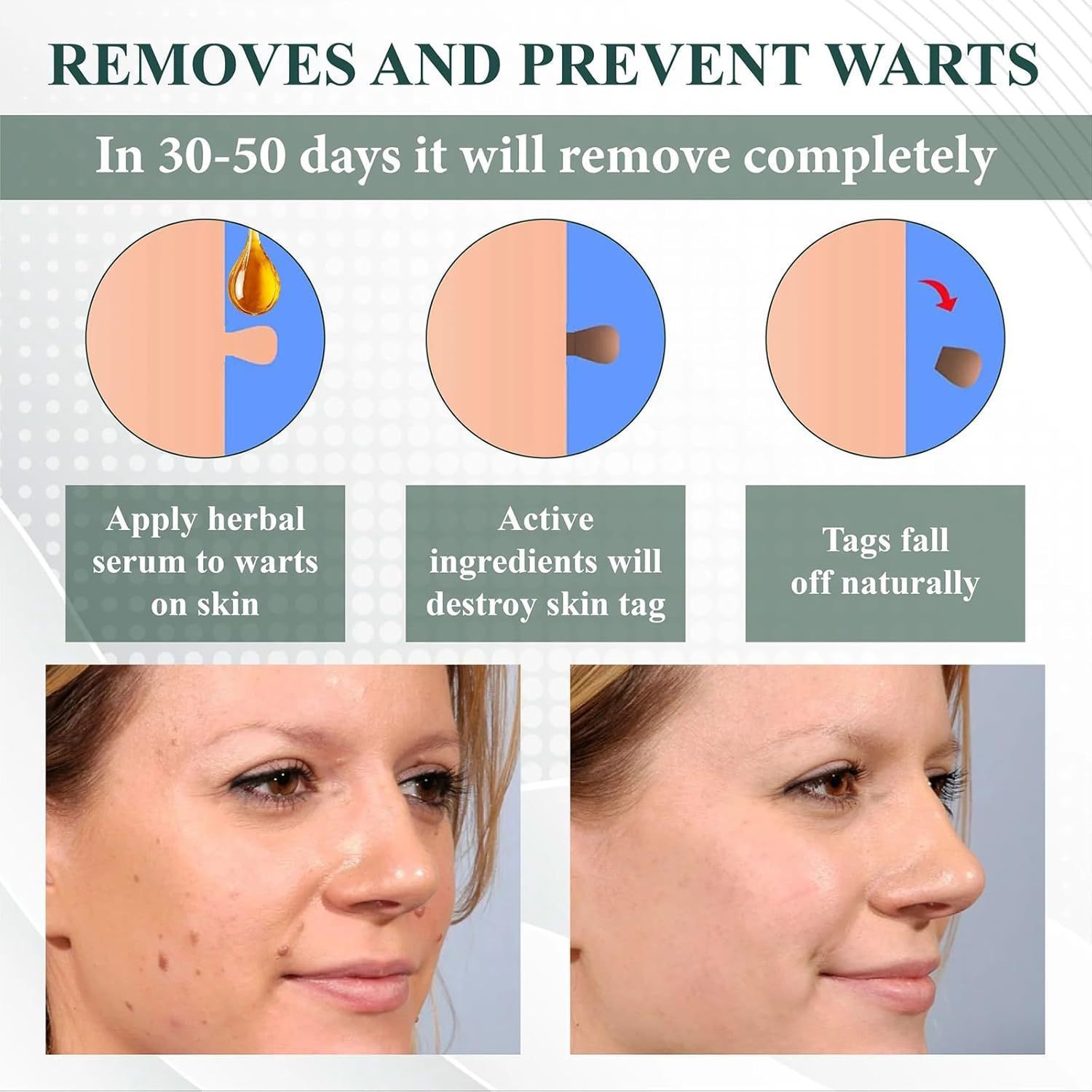Mole Spot Removal Gel