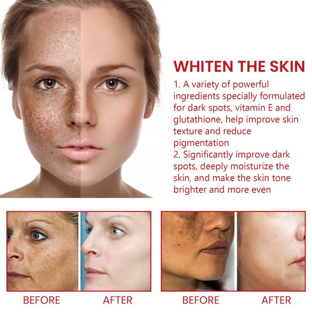 Black Spot Repair Cream