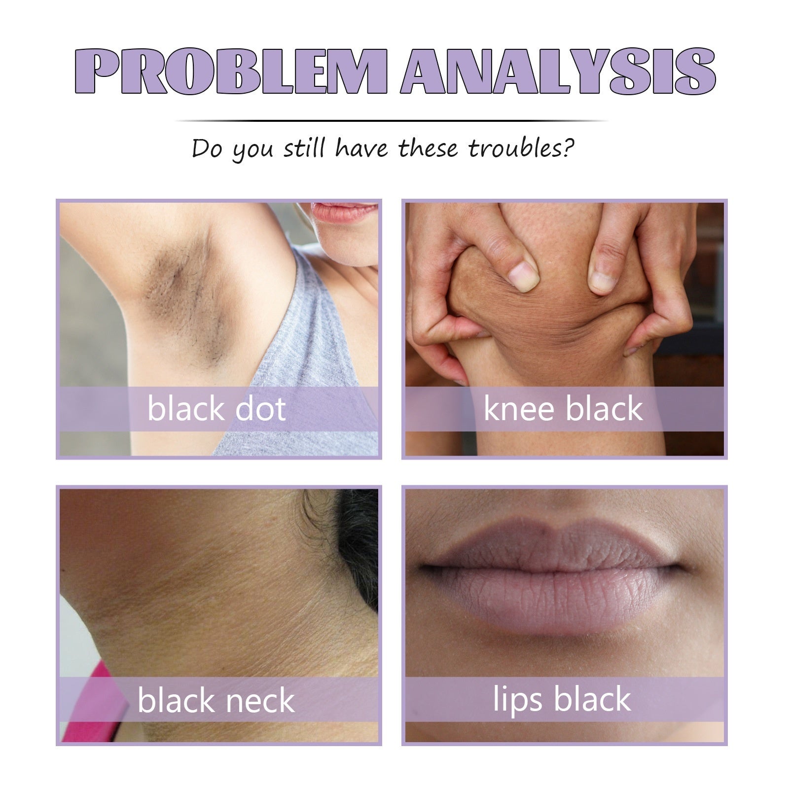 Black Spot Cream